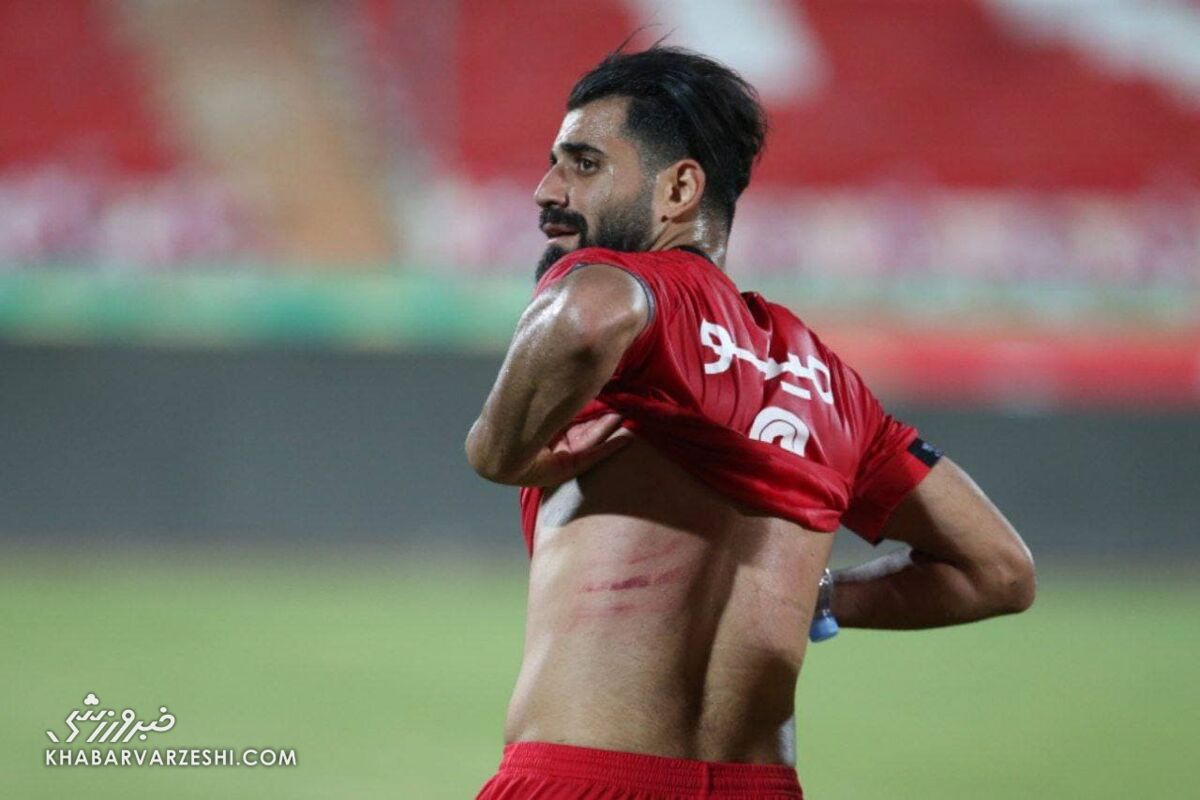 تصویر زخم‌های بدن کنعانی زادگان پس از حرکت خشن بازیکن آلومینیوم/ منصوریان عذرخواهی کرد