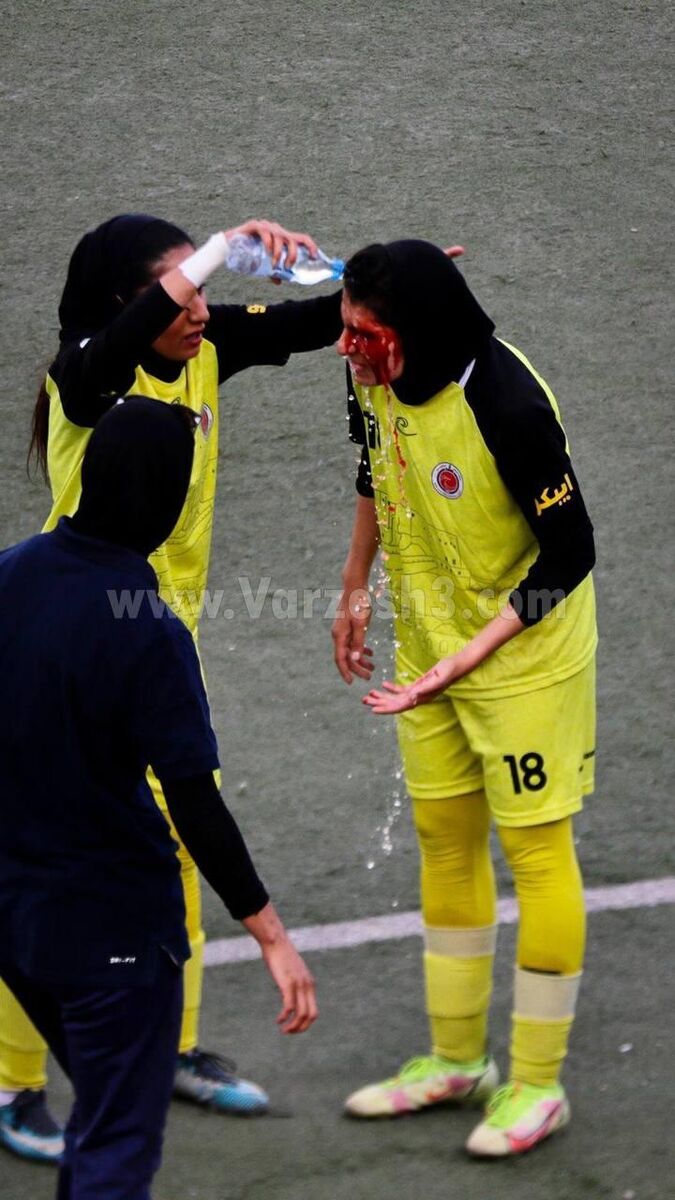 عکس | تصویری وحشتناک از فوتبال زنان ایران/ صورت خونین یک بازیکن و جراحی وسط بازی!