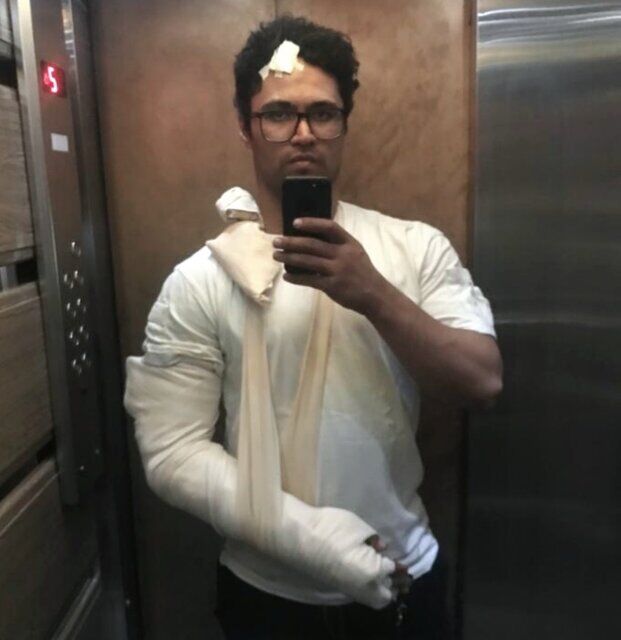 عکس| ملی پوش ایران را با چاقو زدند/ ماجرای درگیری نایب قهرمان جهان در کافه