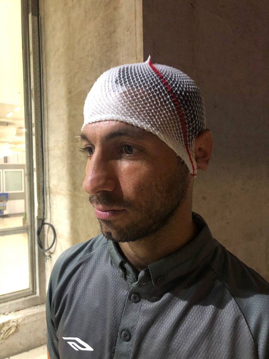 عکس| فقط محمود فکری کتک نزده است/ سایپا هم از مصدوم خود رونمایی کرد