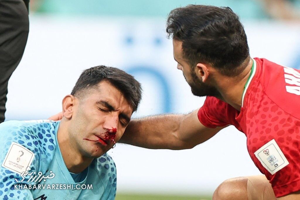 آخرین وضعیت بیرانوند بعد از انتقال به بیمارستان/ گلر اول ایران جام جهانی را از دست داد؟