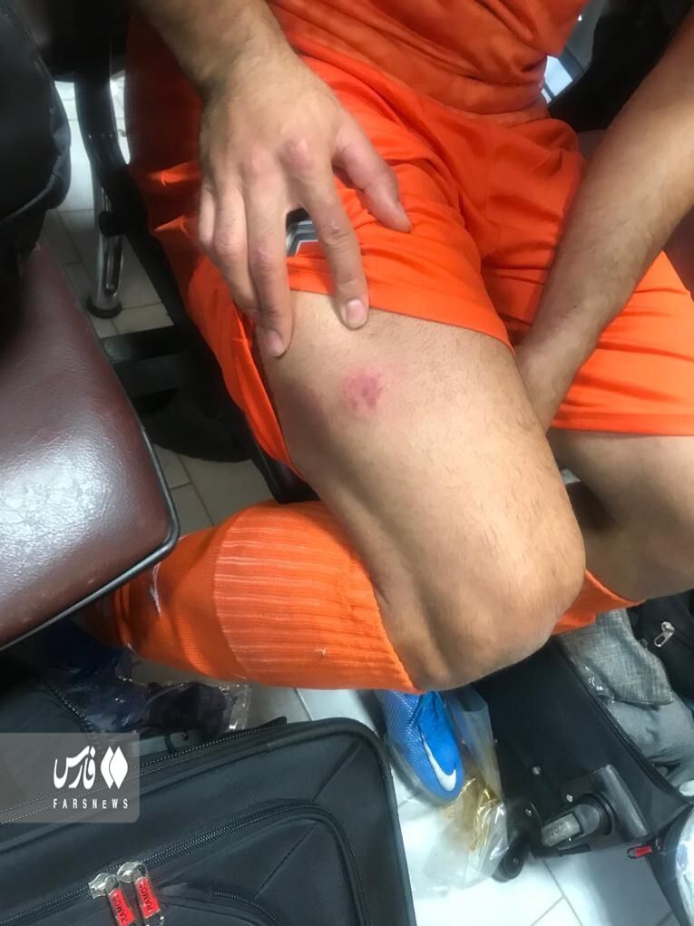 تصاویر | گاز گرفتن پای بازیکن توسط دروازه‌بان استقلال/ روح لوئیس سوارس در فوتبال ایران ظاهر شد!