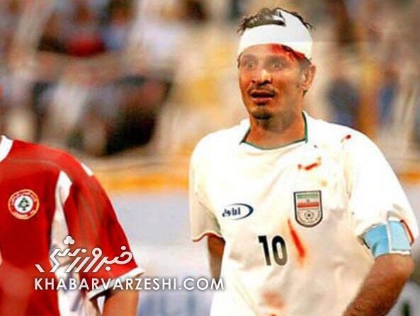 سر شکسته علی دایی