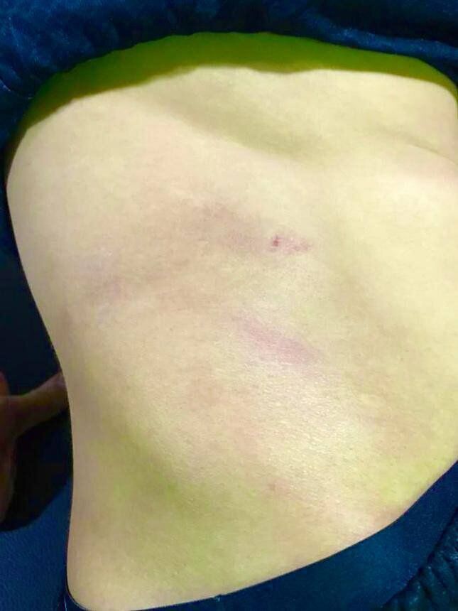 عکس| باشگاه استقلال علیه تراکتور سند رو کرد/ رد پای ضربه وحشتناک رو بدن ستاره آبی ها