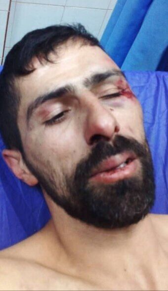 تصاویری از حمله اراذل به ستار صید؛ دلیل حمله اوباش مشخص شد/ ورزشکار ایرانی جان سالم به در برد!