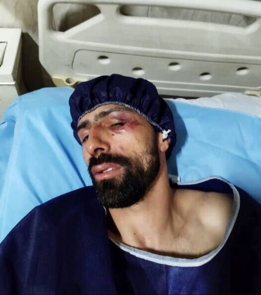 تصاویری از حمله اراذل به ستار صید؛ دلیل حمله اوباش مشخص شد/ ورزشکار ایرانی جان سالم به در برد!