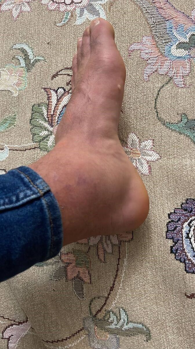 تصویر نگرانکننده برای ساپینتو و هواداران استقلال