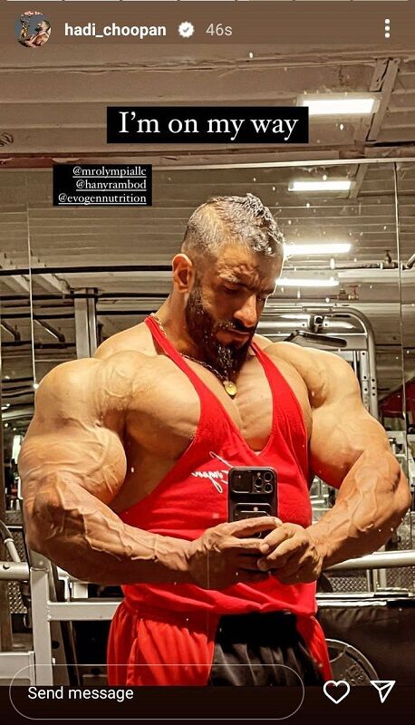 تصویری غافلگیر کننده از مدل موهای هادی چوپان/ ژست ترسناک گرگ پارسی مقابل دوربین