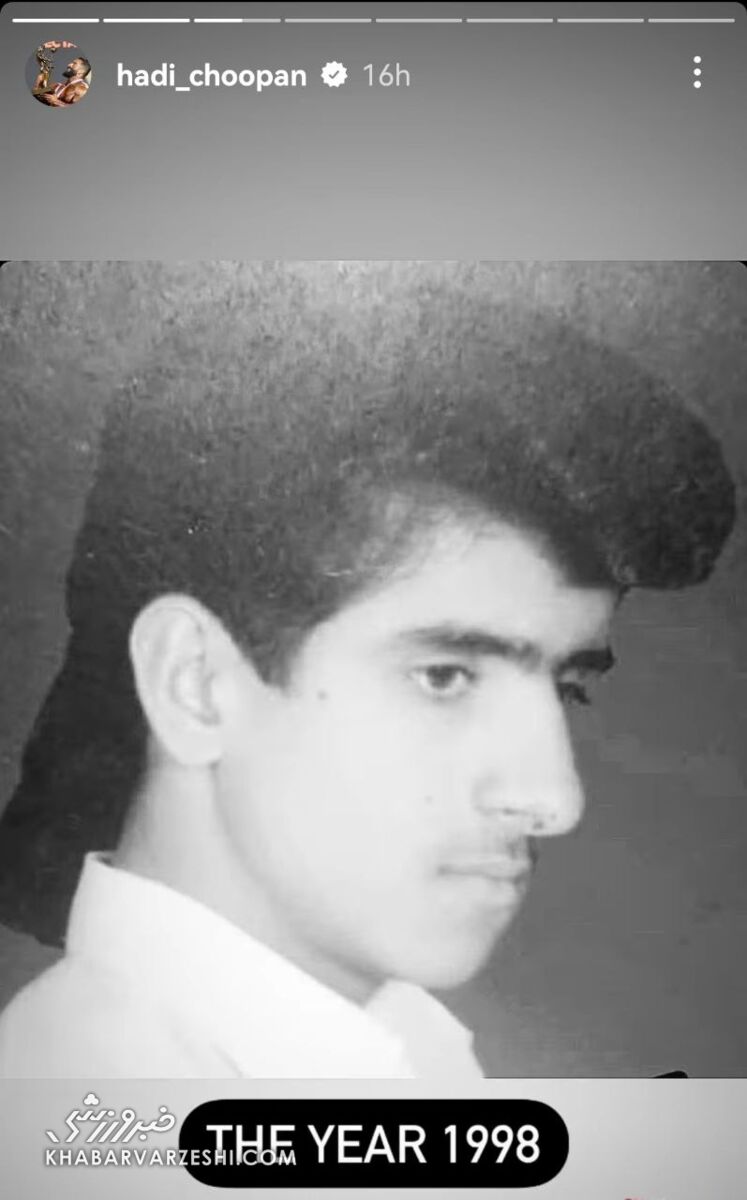 تصویر باورنکردنی از هادی چوپان/ گرگ ایرانی با پشت مو کفتری کاربران را متحیر کرد!