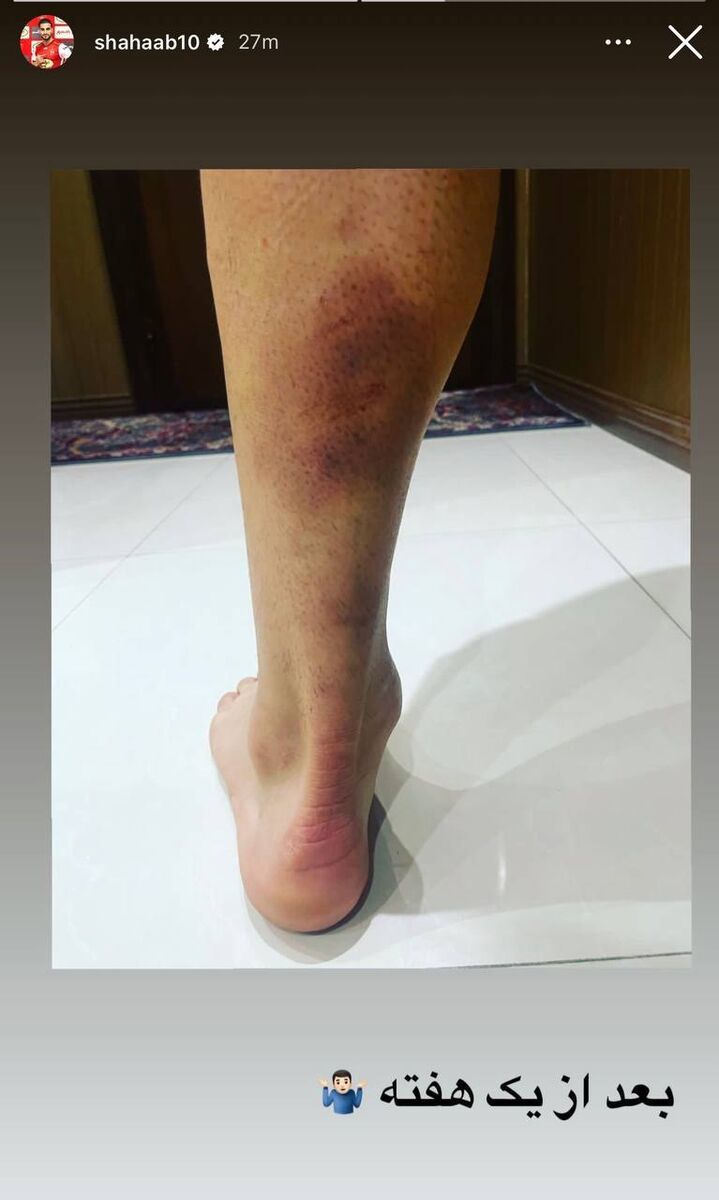 عکس| مصدومیت دردناک شهاب زاهدی مقابل فولاد/ پنالتی اخراج پرسپولیس اثبات شد؟