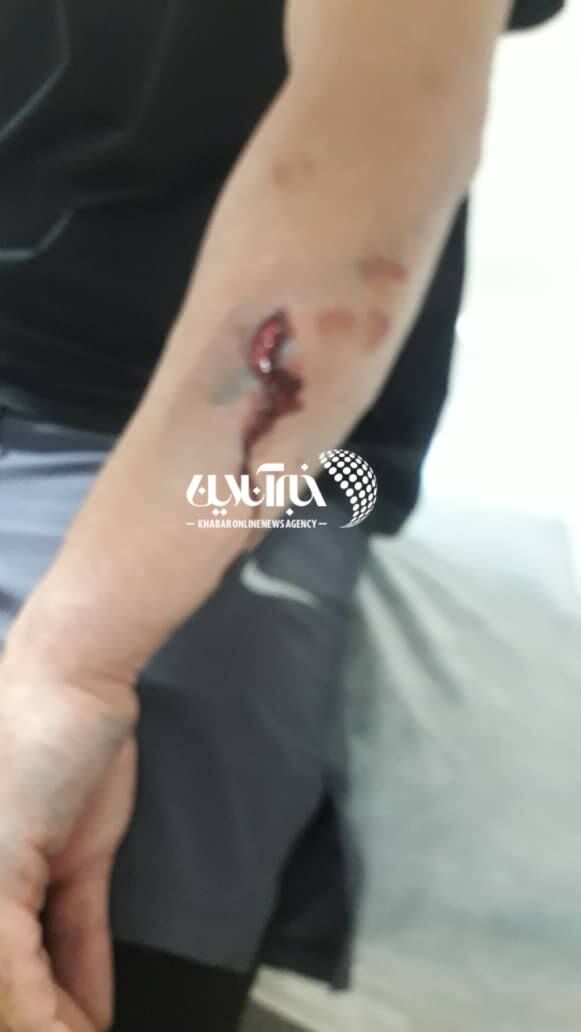 عکس| سارقها به ستاره سابق پرسپولیس حمله کردند