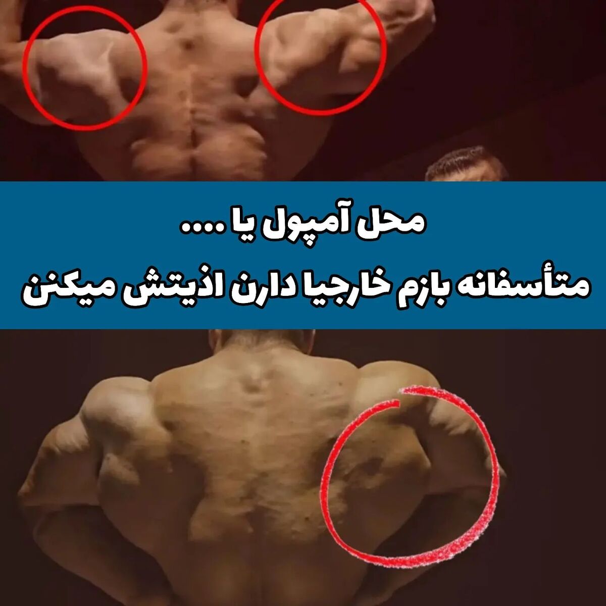 عکس| اتهام باورنکردنی بدنساز مشهور علیه هادی چوپان؛ گرگ ایرانی سینتول تزریق کرده!