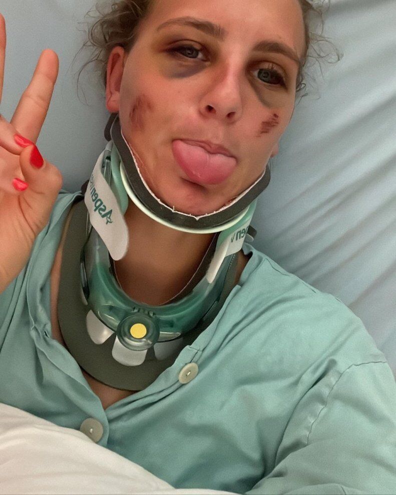 تصاویر| دختر دروازهبان از مرگ گریخت و به زمین فوتبال بازگشت/ نجات معجزهآسا بعد از تصادف وحشتناک