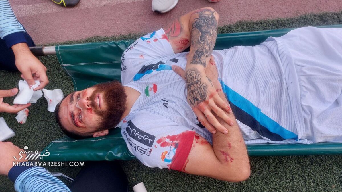 تصویر دلخراش از جهانبخش/ برخورد سنگین این بازیکن را به بیمارستان فرستاد