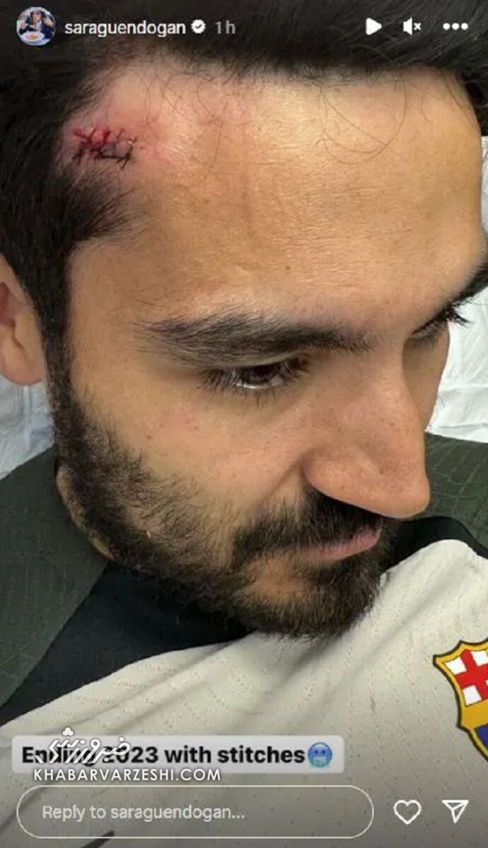 عکس| پایان سال ۲۰۲۳ با چند بخیه!