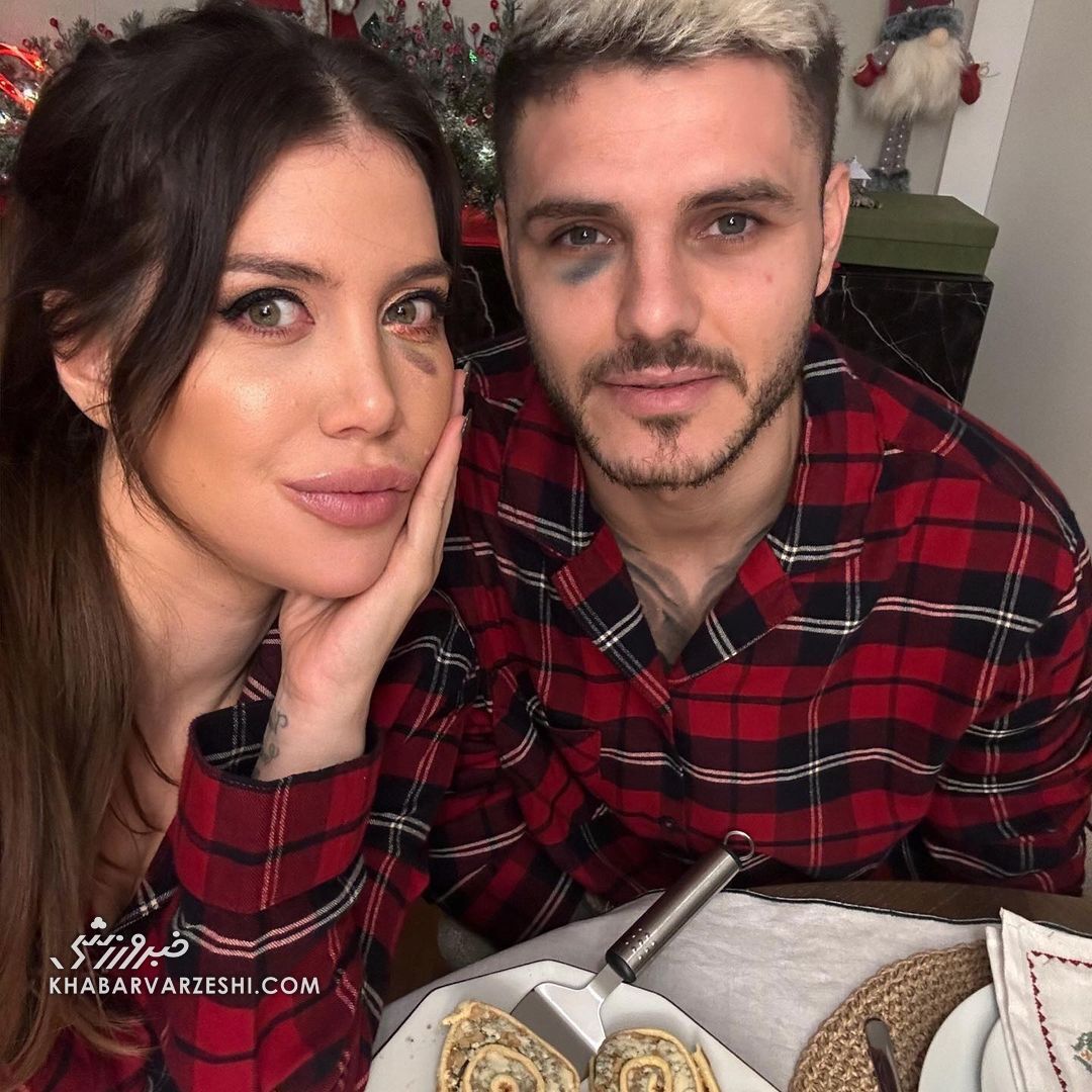 عکس| پشت پرده کبودی زیرچشم واندا نارا و ایکاردی