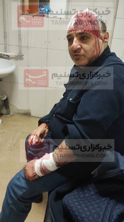 عکس| حمله وحشیانه و خونین به رئیس فدراسیون ایران/ ناشناسهای قمه به دست گریختند!