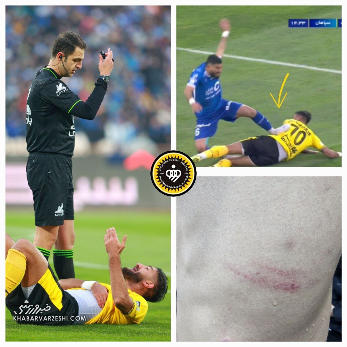 عکس| مصدومیت دلخراش مغانلو با لگد بازیکن استقلال/ این خطا اخراج داشت؟
