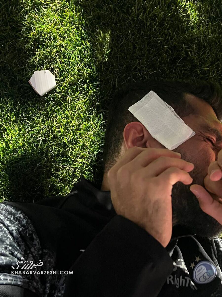 تصاویر| حادثه خونین پیش از شروع دربی؛ سر ستاره استقلال با سنگ پرسپولیسیها شکست!