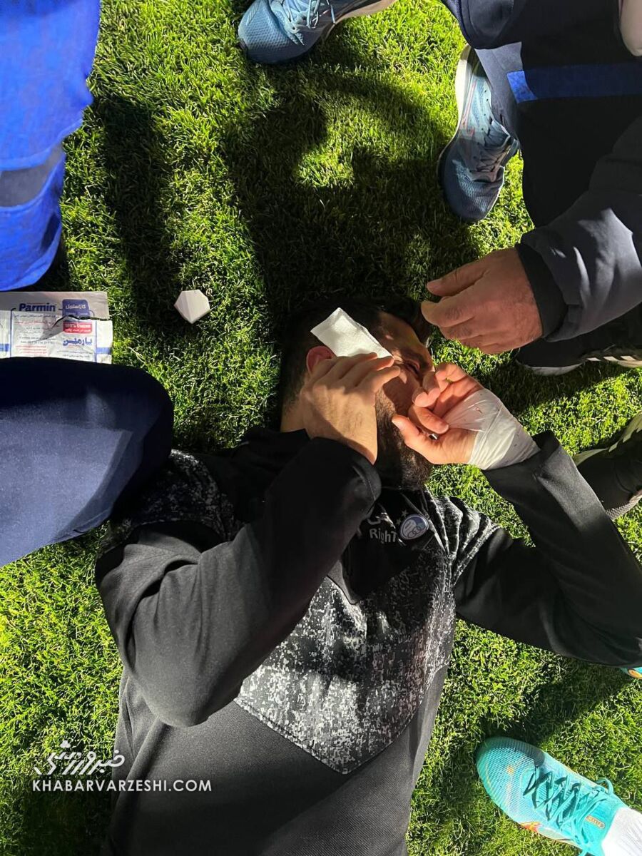 تصاویر| حادثه خونین پیش از شروع دربی؛ سر ستاره استقلال با سنگ پرسپولیسیها شکست!