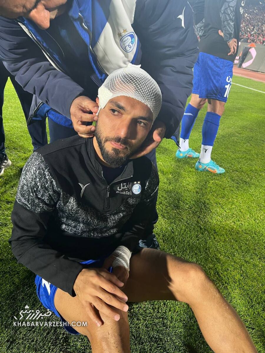 تصاویر| حادثه خونین پیش از شروع دربی؛ سر ستاره استقلال با سنگ پرسپولیسیها شکست!