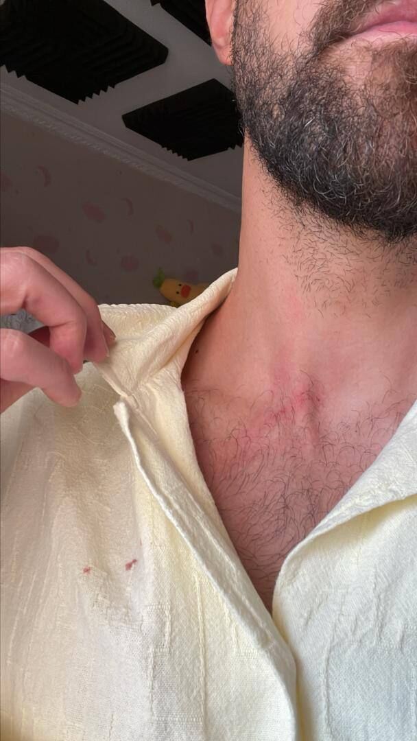 واکنش پلیس به حمله سارقان به مهاجم سابق استقلال