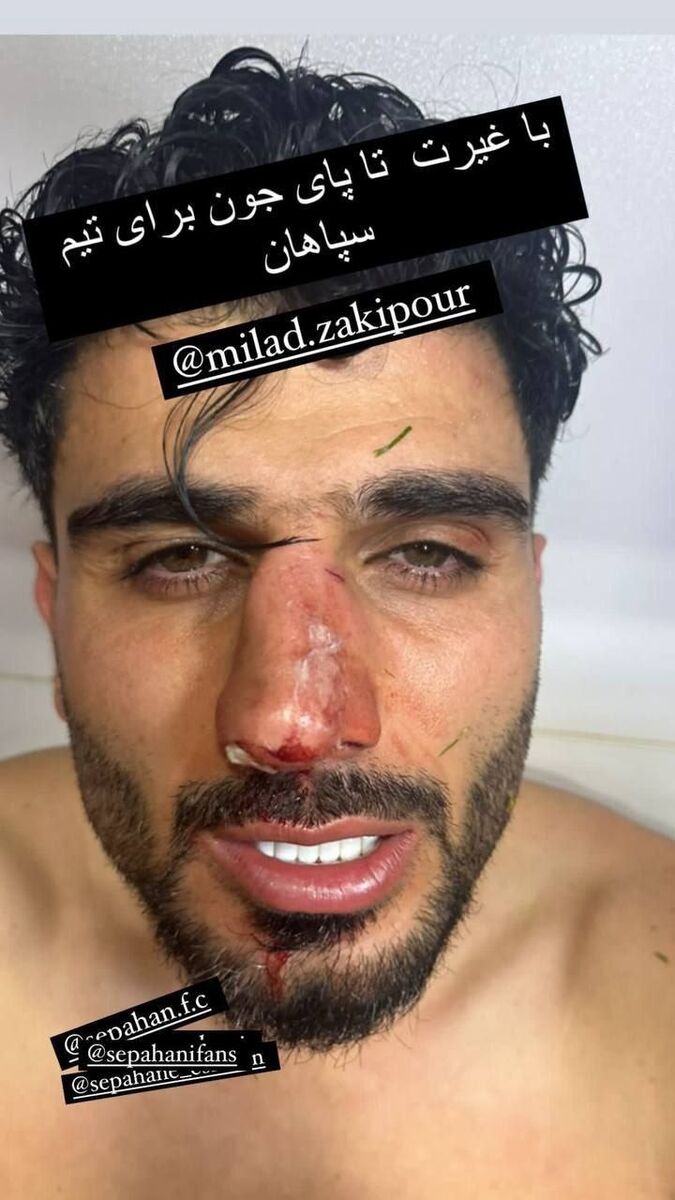 عکس| مصدومیت دلخراش زکیپور پس از برخورد سنگین/ بینی مدافع سپاهان شکست!