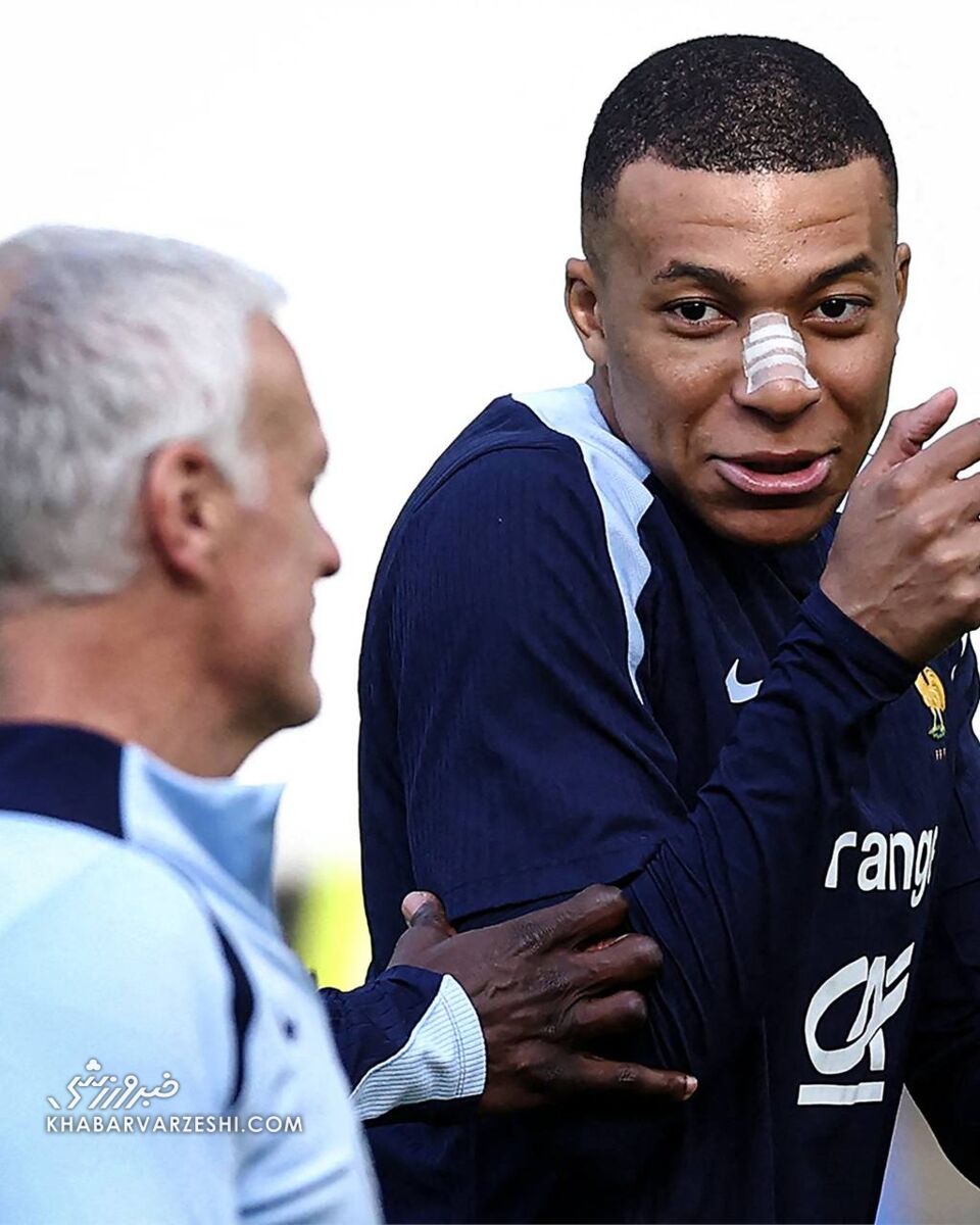 عکس| ظاهر جدید امباپه بعد از شکستن بینی