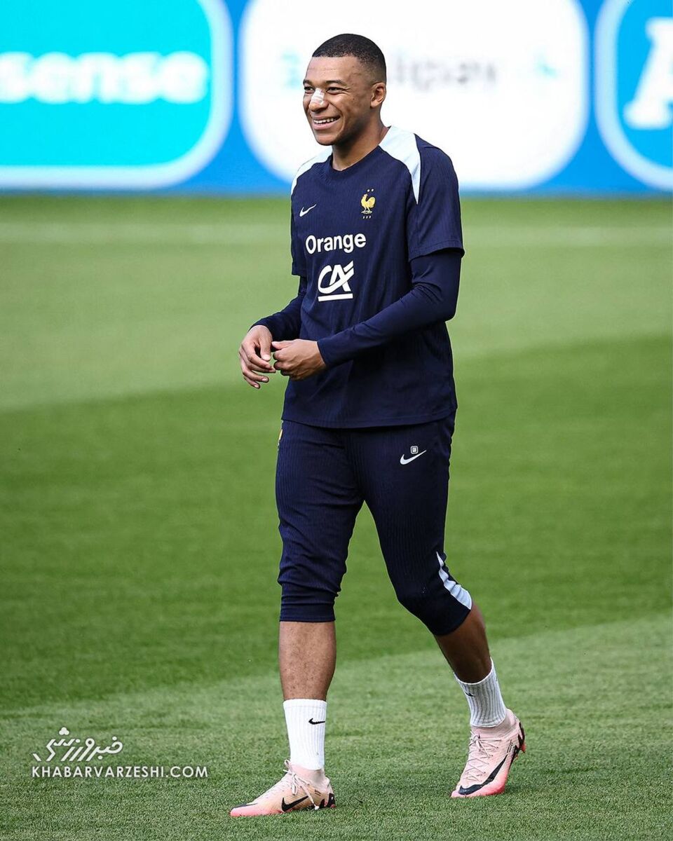 عکس| ظاهر جدید امباپه بعد از شکستن بینی