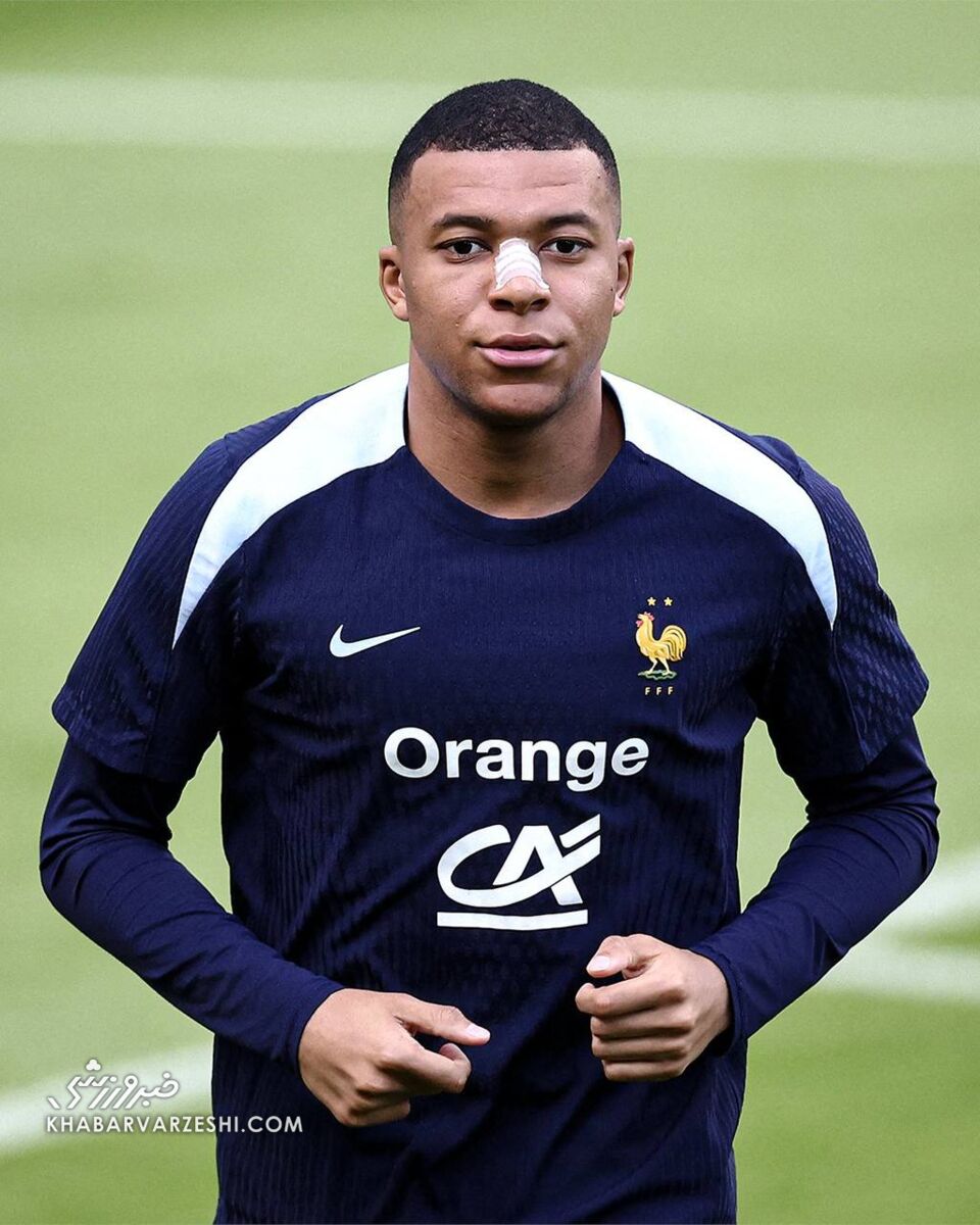 عکس| ظاهر جدید امباپه بعد از شکستن بینی