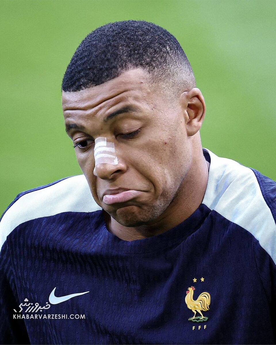 عکس| ظاهر جدید امباپه بعد از شکستن بینی