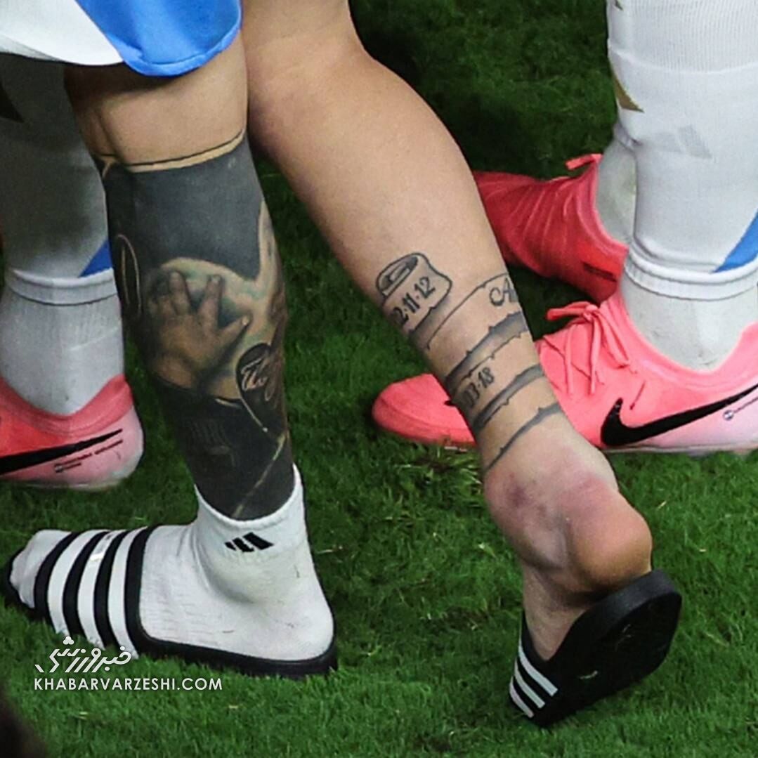 تصویری دلخراش از مصدومیت مسی/ مچ پای متورم اسطوره و اشکهایش در کوپا آمریکا +تصاویر