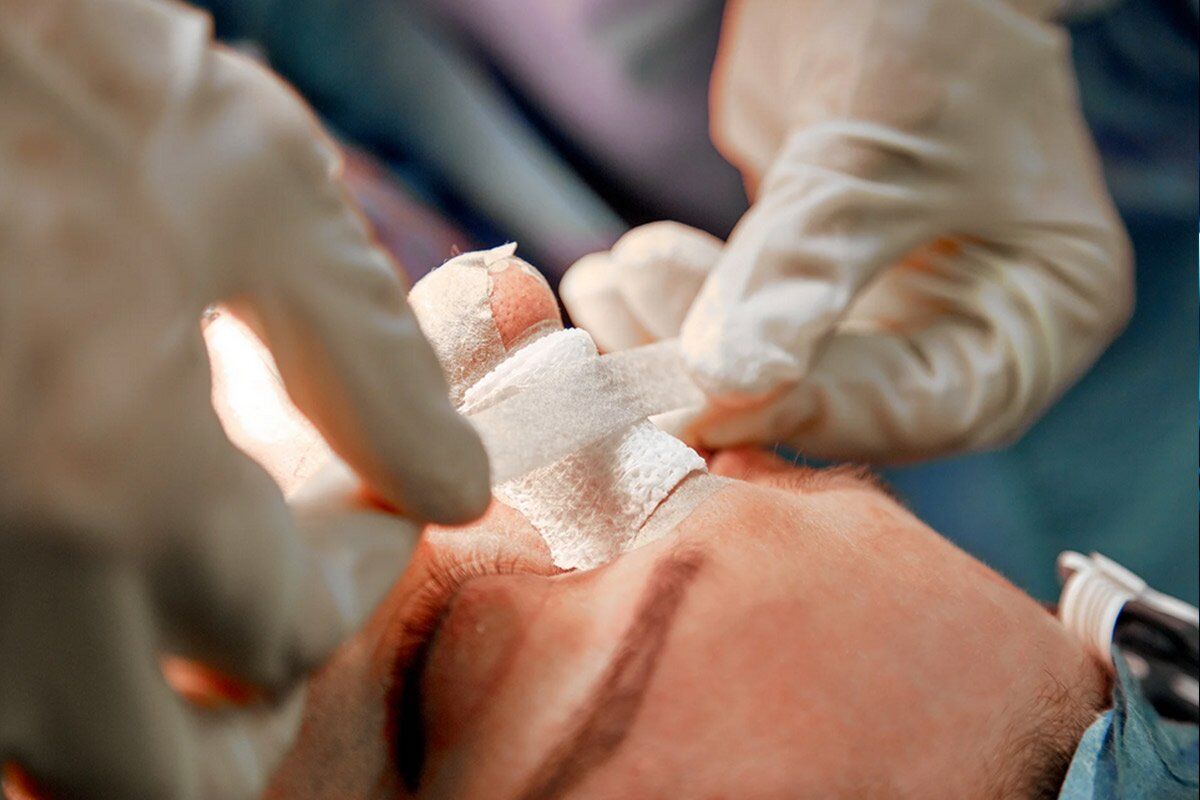 مراقبتهای بعد از جراحی بینی