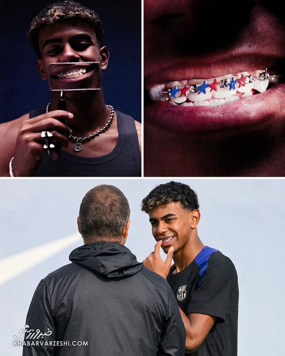 دندانهای اعجوبه بارسلونا برای الکلاسیکو ستاره شدند! +عکس