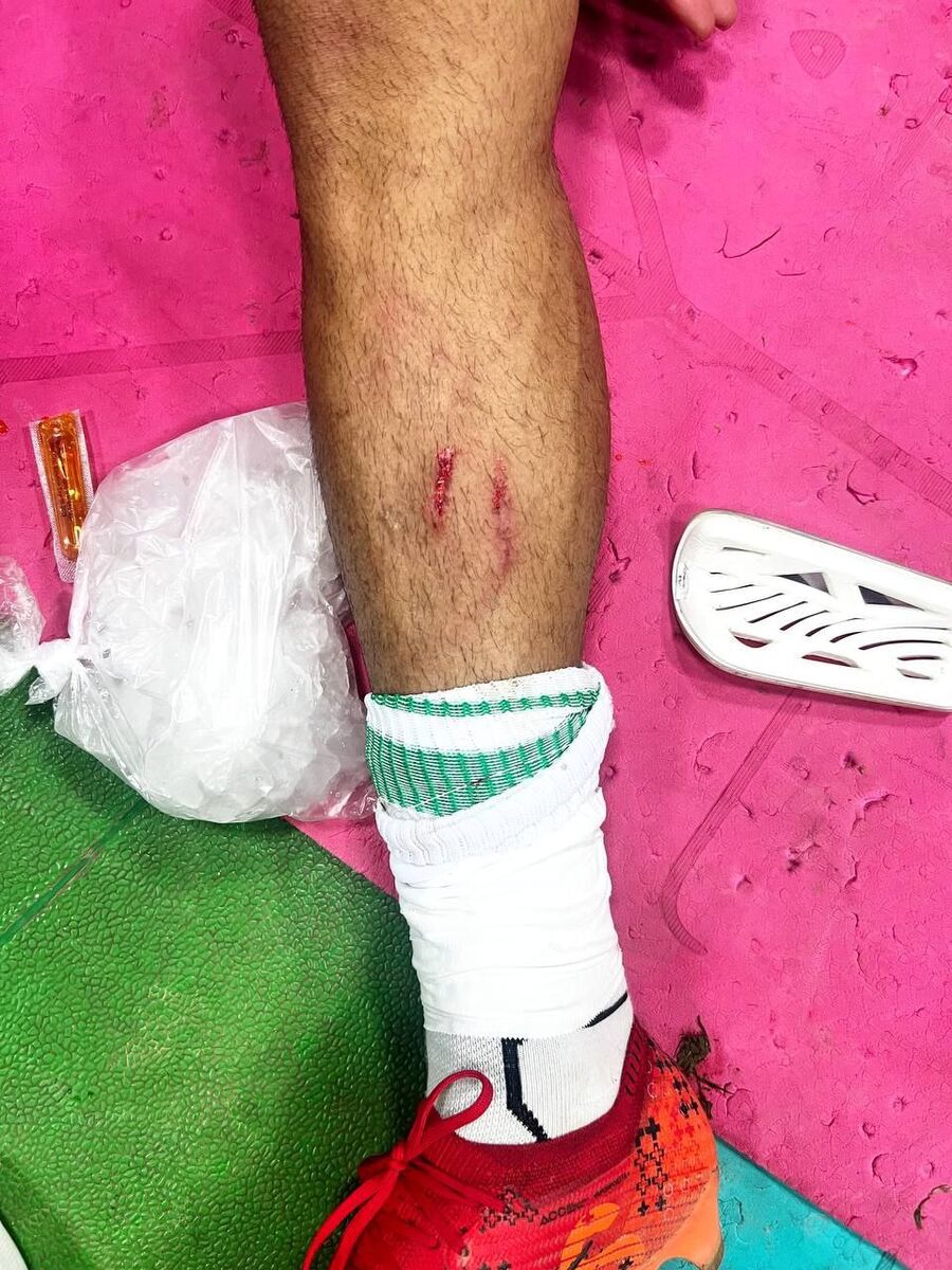 کنایه باشگاه خیبر به داوری دیدار با نساجی +عکس