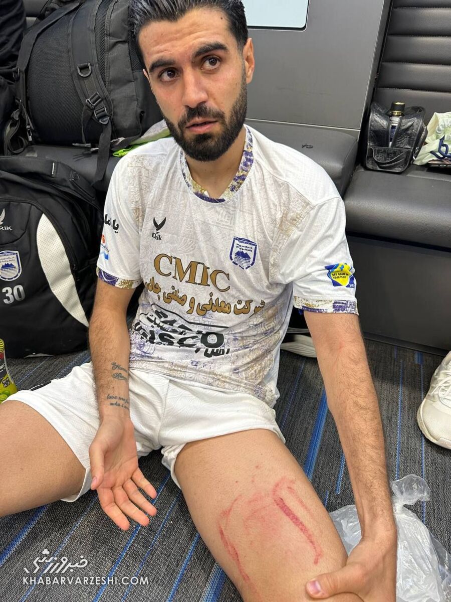 خراش شدید پای بازیکن حریف استقلال / اعتراض چادرملو به نبودن VAR +عکس
