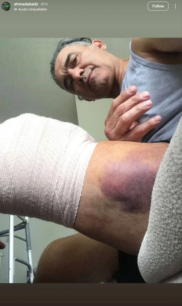 عقاب همیشه عقاب است، حتی بدون مفصل! + عکس