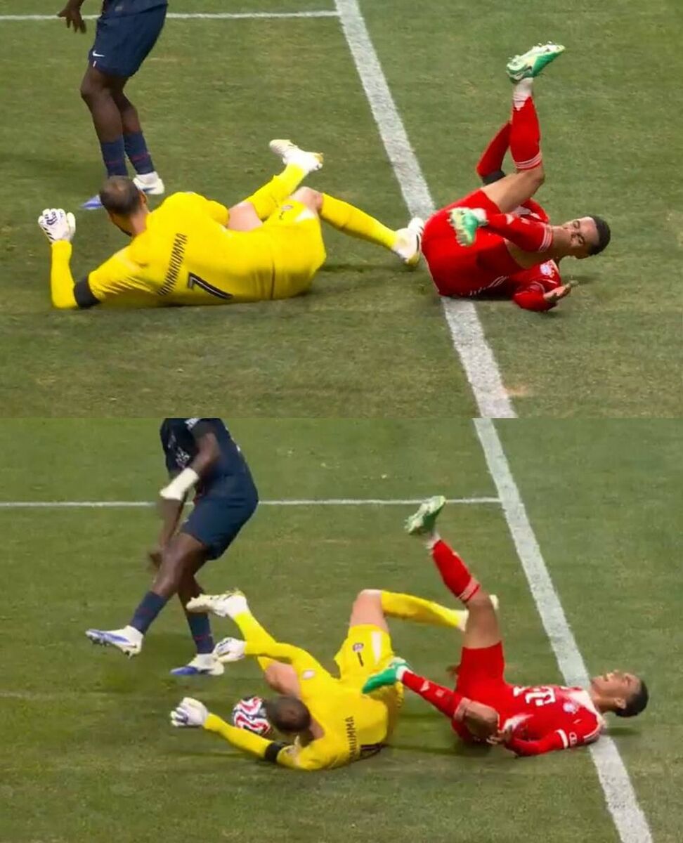 هشدار تصویر دلخراش/ شکستگی وحشتناک پای موسیالا؛ عامل مصدومیت اشک ریخت و به رختکن نرفت!