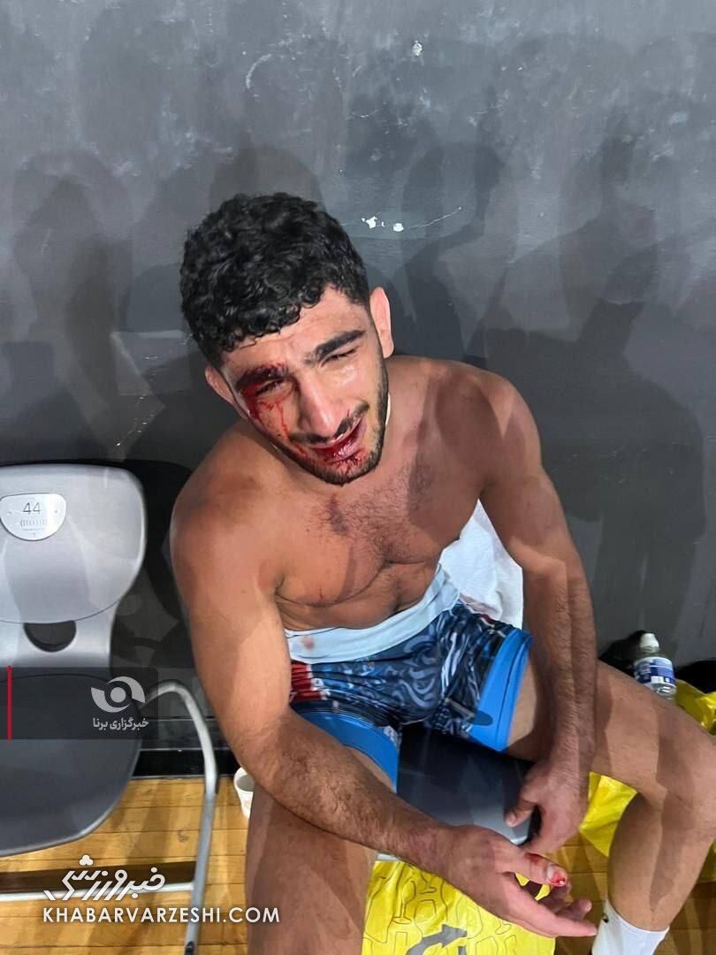 مصدومیت دانیال سهرابی