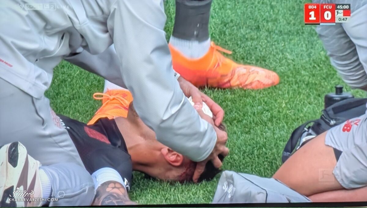 وحشت در بوندسلیگا و شوک به تیم ملی اسپانیا؛ فواره خون روی سر ستاره فوتبال +عکس