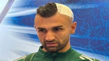 هشدار ویدیو دلخراش؛ سر سردار دورسون شکست!