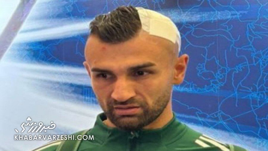 هشدار ویدیو دلخراش؛ سر سردار دورسون شکست!