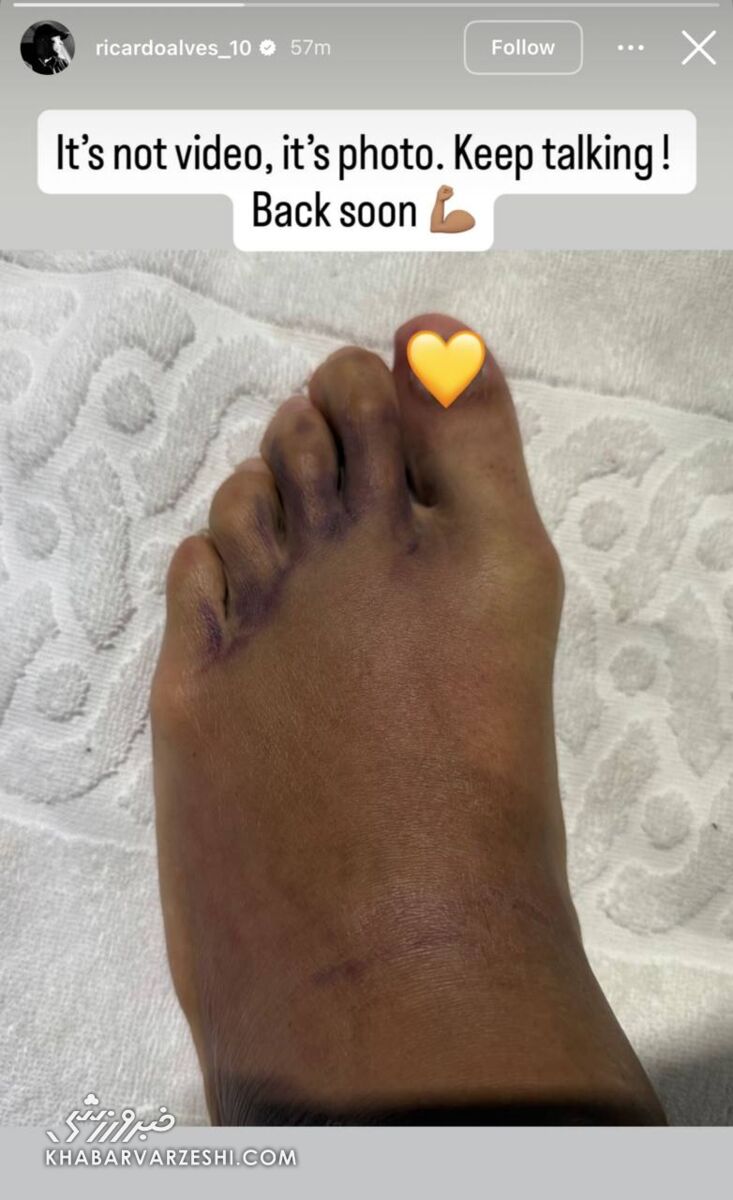 استوری الوز