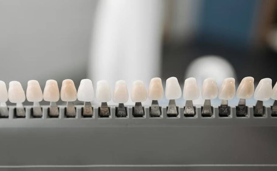  لمینت دندان