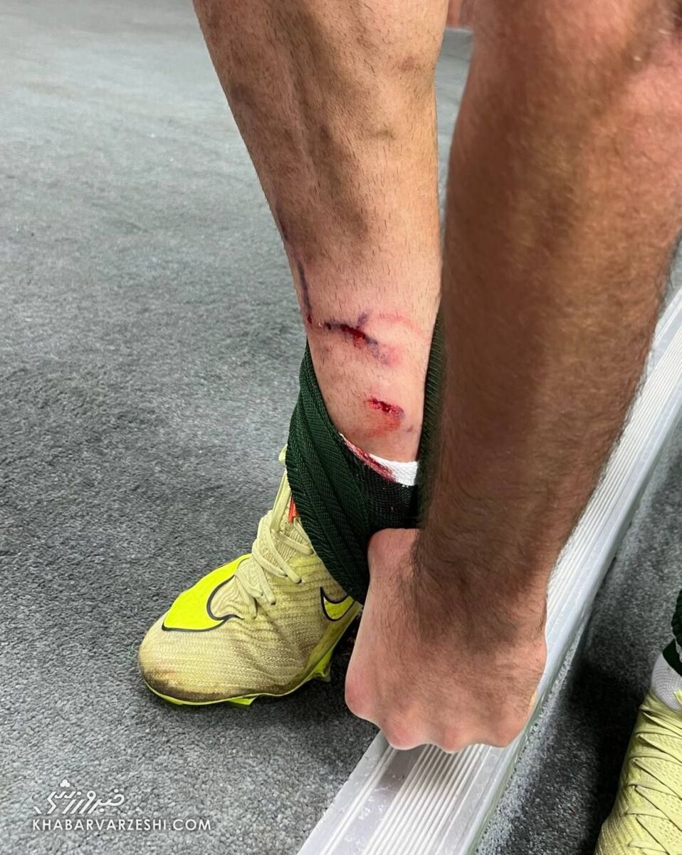 سند دلخراش آلومینیوم؛ حرکت بازیکن پرسپولیس اخراج داشت؟ +عکس و ویدیو