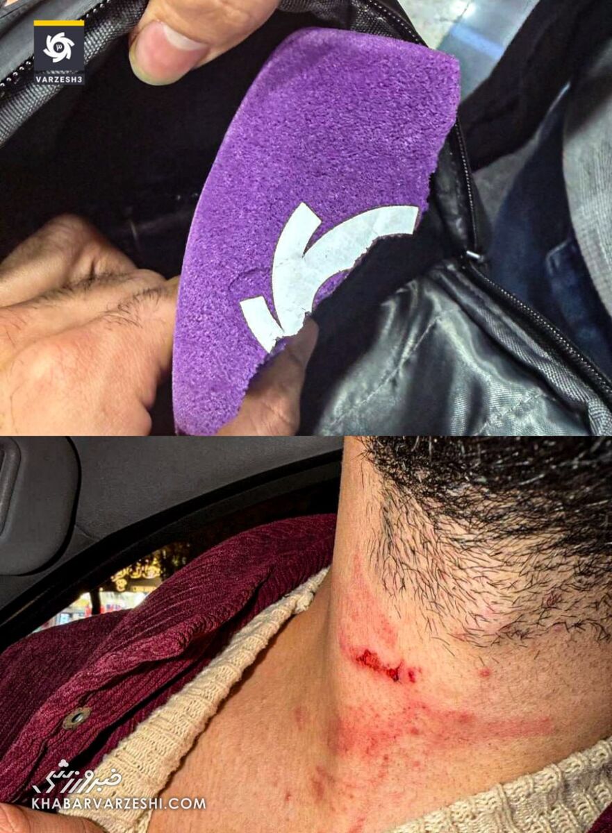 فاجعه جدید در فوتبال ایران با حادثه تلخ وتکان دهنده/ حمله فیزیکی به خبرنگاران +عکس