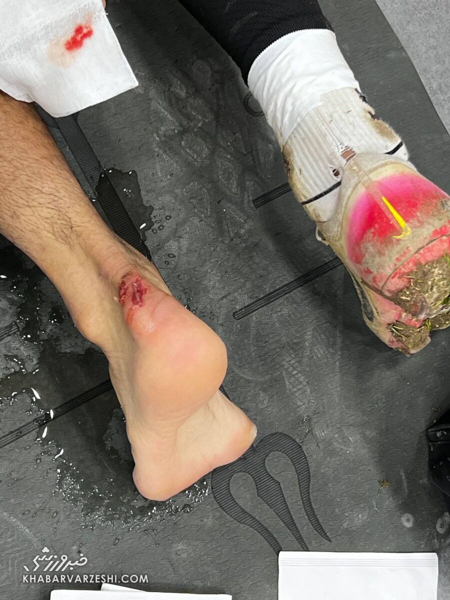 تصویر دلخراش بازیکن خیبر/ ضربه مهاجم استقلال کارت قرمز داشت؟ +عکس