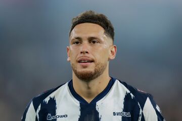 صورت این ستاره فلج شد! +عکس