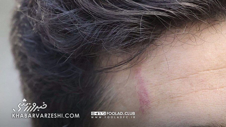 ویدیو| اعتراض تصویری فولاد: این اخراج نداشت!