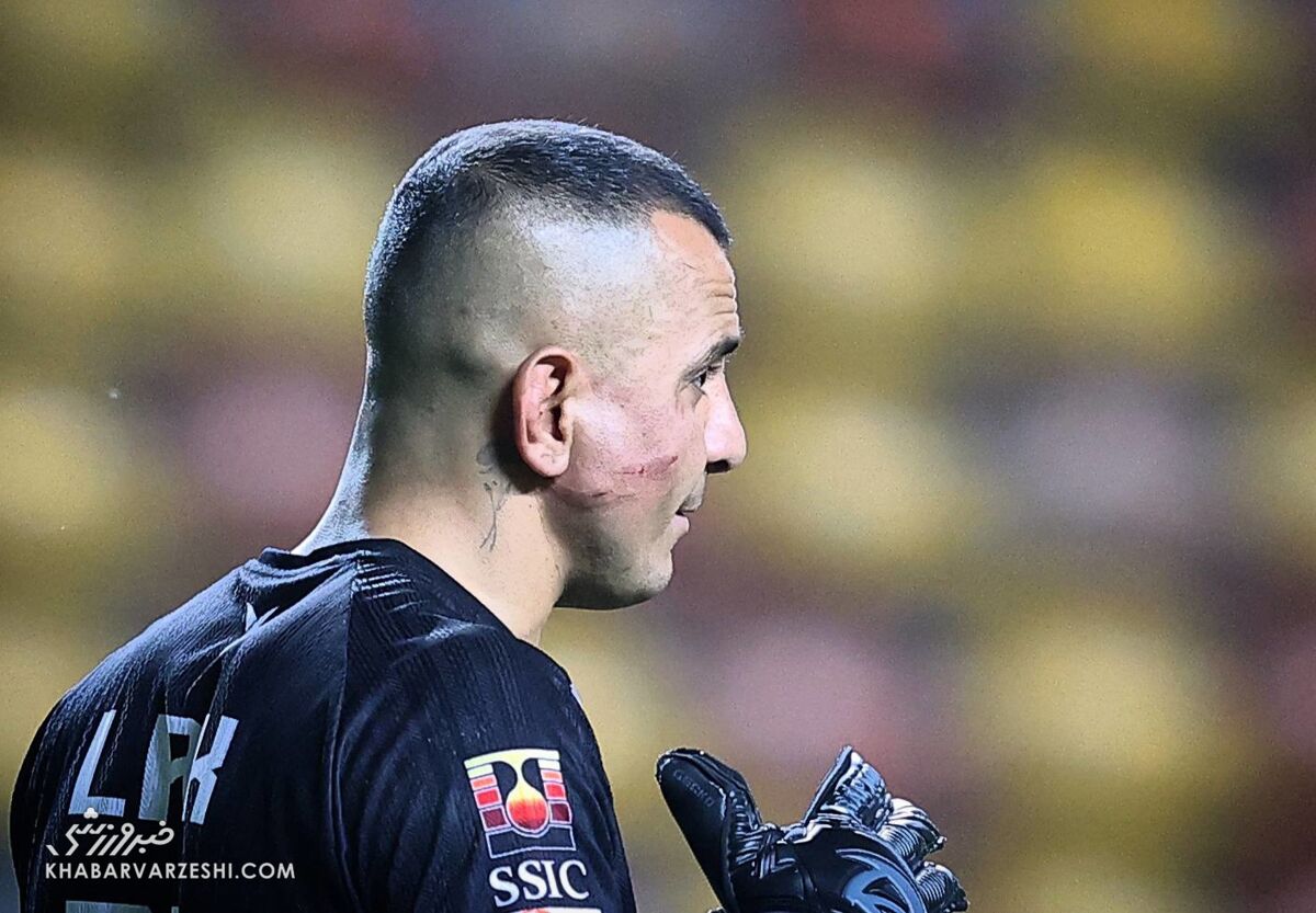 ستاره سابق پرسپولیس در نقش «صورت زخمی»/ ماجرای تغییر سناریو با حرکت شجاعانه +عکس